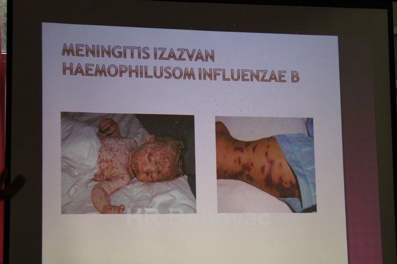 IMG3412-CijepljenjePredavanje